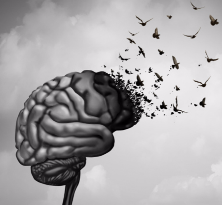 نوع جدیدی از زوال عقل شناسایی شد