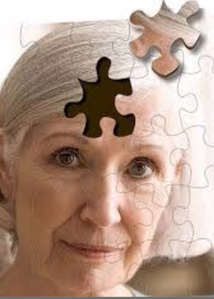 هورمون‌ها عامل بیشتر آلزایمر در زنان