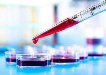 تشخیص آلزایمر