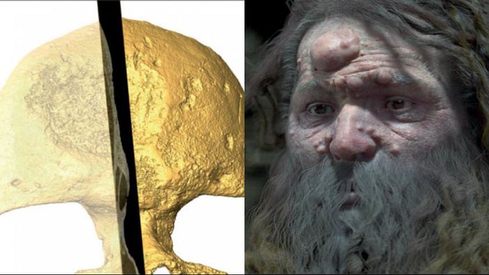 کشف راز حفره در جمجمه انسان کرومانیون/ چهره بازسازی شد