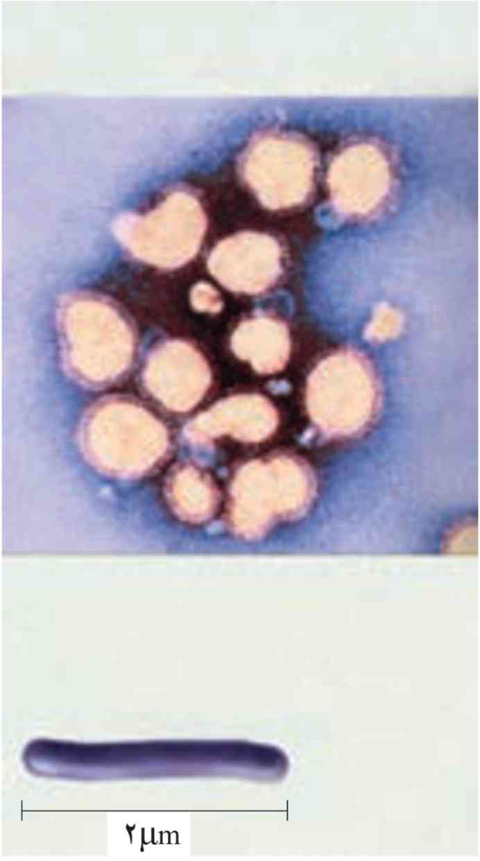 ویروس آنفلوآنزا