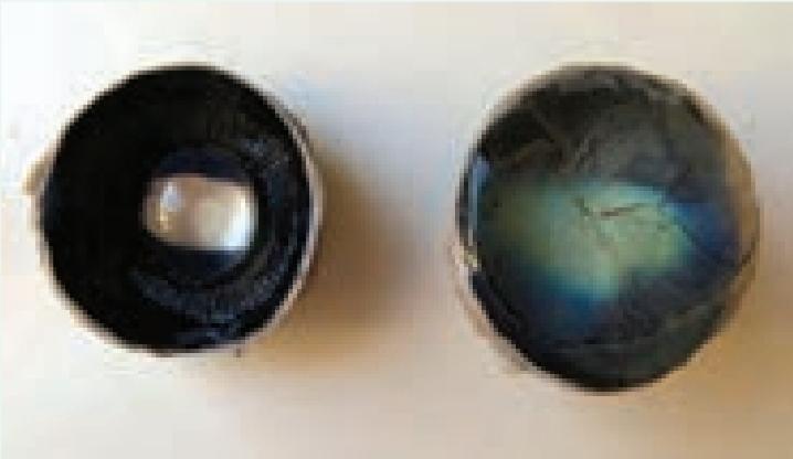 کره چشم برش خورده