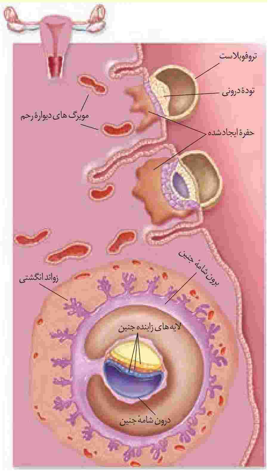 جایگزینی جنین در رحم
