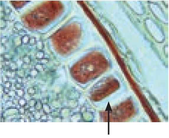 یاخته هایی که گلوتن در واکوئول آنها ذخیره شده است