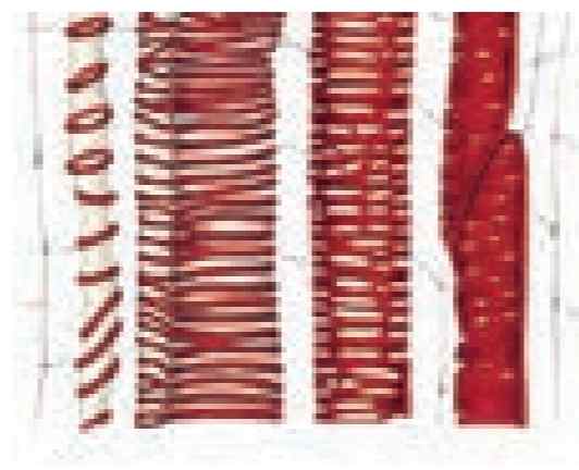 آوندهای چوبی به شکل‌های متفاوتی دیده می‌شوند