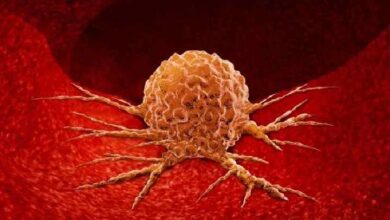 تقسیم یاخته؛ رِشتمان (میتوز)؛ تومور؛ سرطان؛ زیستشناسی یازدهم