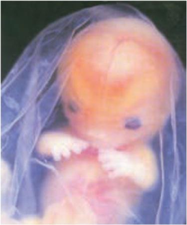 انگشتان نسبت به ساعد دست به وضوح تشخیص داده می‌شوند.