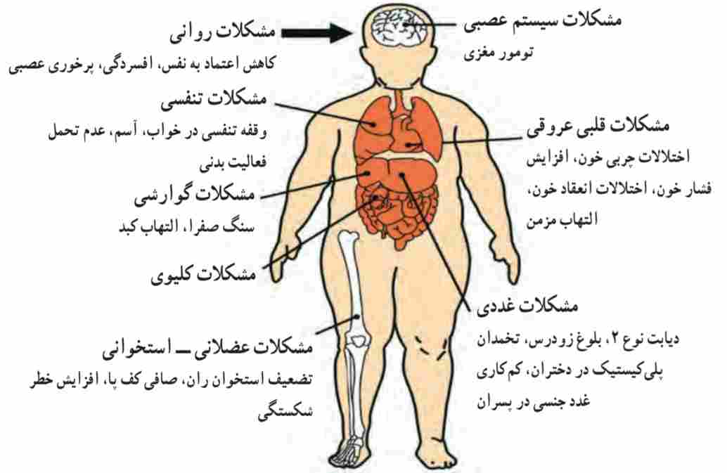 عوارض چاقی