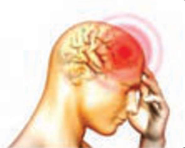 نوع دوم، سکته خون‌ریزی است