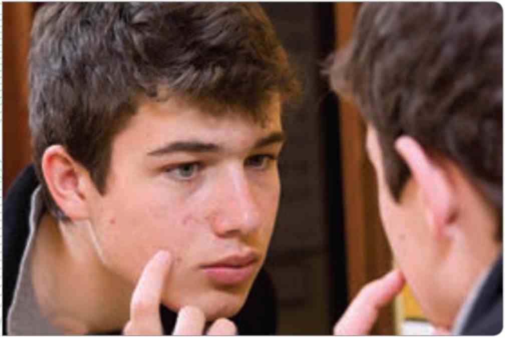 ویژگی‌های جنسی ثانویه