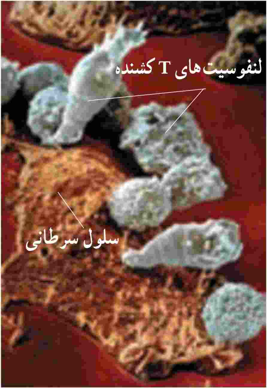 ریزنگار الکترونی از لنفوسیت‌های T کشنده در حال حمله به یک سلول سرطانی