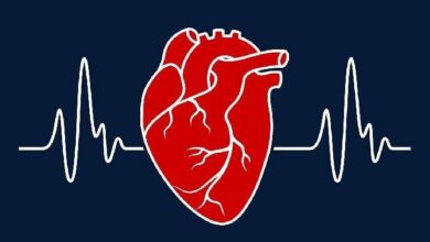 علل و علائم ایست قلبی؛ اقدامات اولیه حفظ حیات؛ احیای قلبی تنفسی