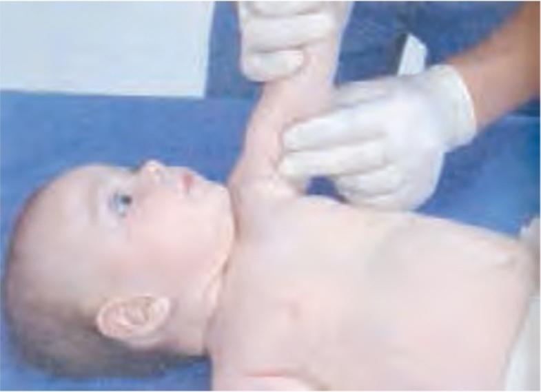 روش کنترل نبض در کودکان