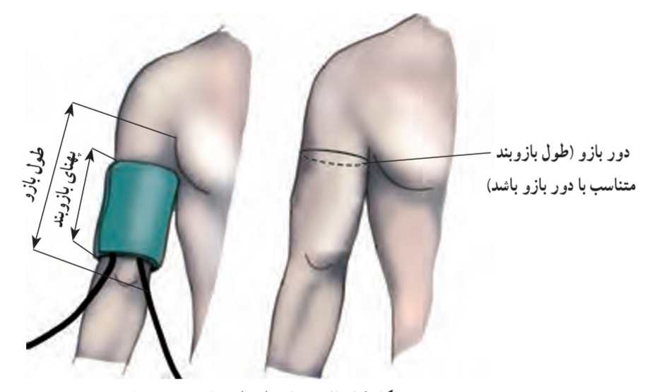 محل قرار دادن بازوبند روی بازو