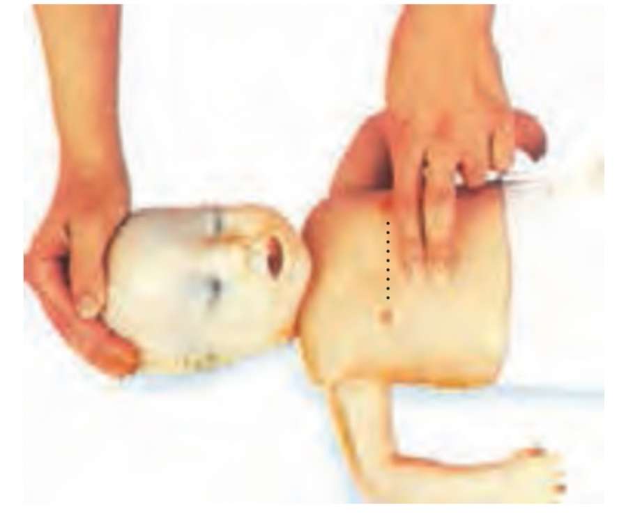 روش اجرای ماساژ قلبی در شیر خواران