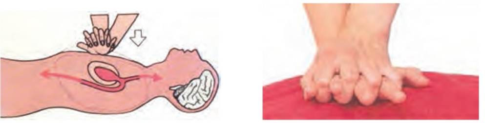 روش قفل کردن انگشتان و بالا نگه داشتن آن‌ها در ماساژ قلبی