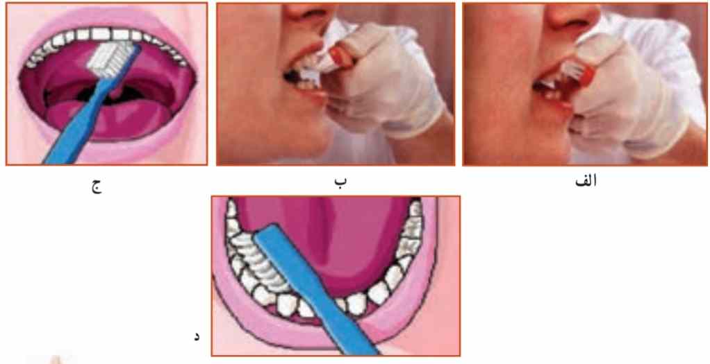 روش صحیح مسواک زدن
