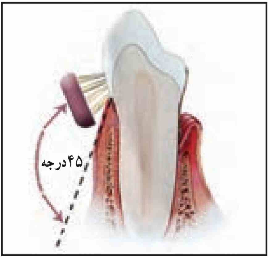 طریقه صحیح قرار گرفتن مسواک روی دندان‌ها