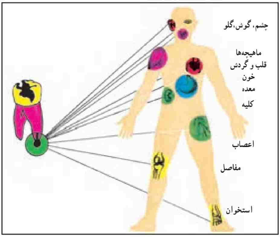 تأثير دندان بیمار در اعضای مختلف بدن