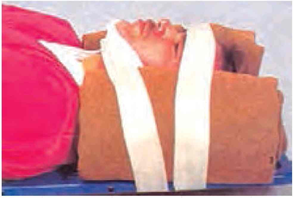 روش ثابت کردن گردن مصدوم در آسيب ستون فقرات