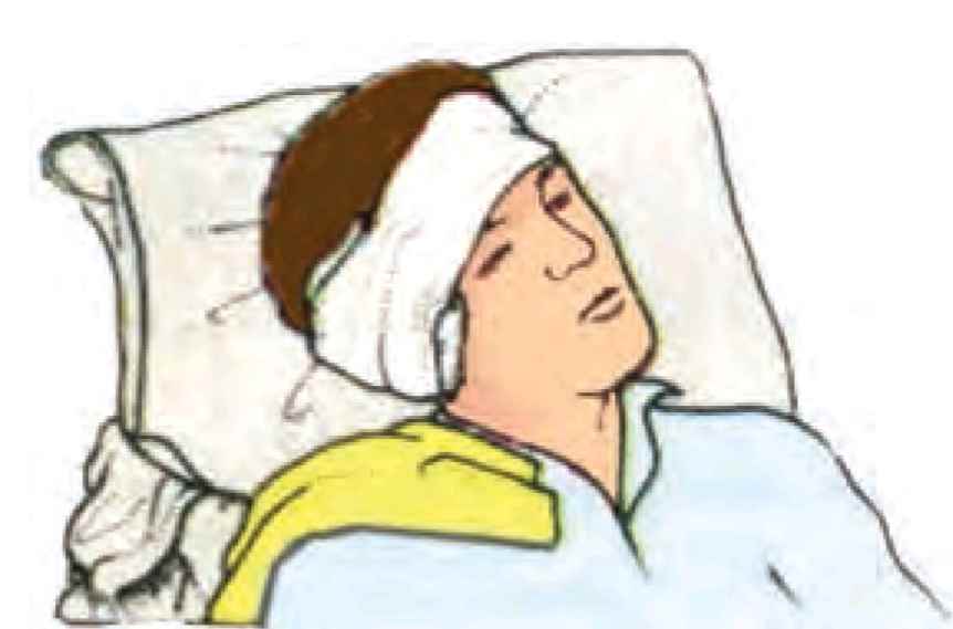 روش باندپیچی گوش در صدمات جمجمه