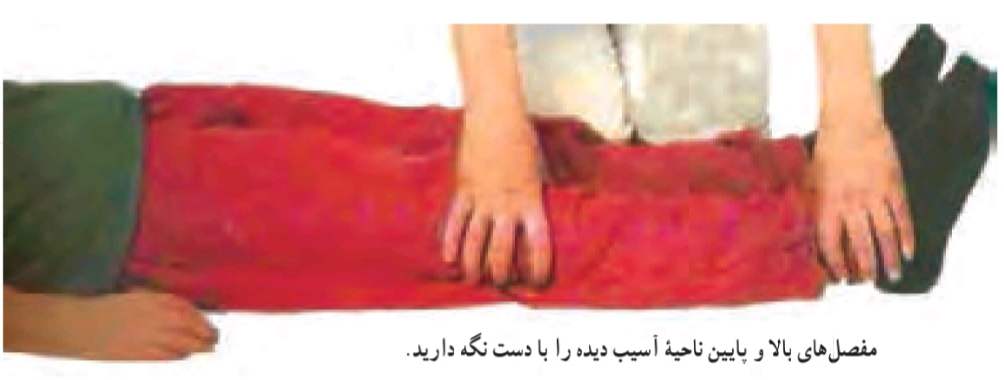 روش ثابت نگه داشتن عضو در شکستگی