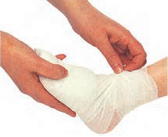 پانسمان خشک پوست سرمازده