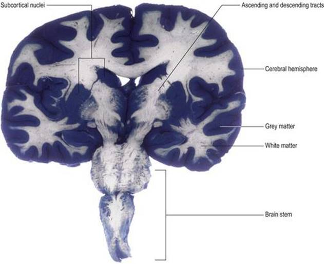 بخش تاجی از طریق مغز که توزیع ماده خاکستری و سفید را نشان می‌دهد