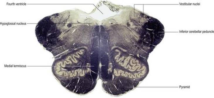 مقطع عرضی از طریق ساقه مغز در سطح بصل النخاع