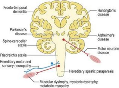 اختلالات دژنراتیو سیستم عصبی عضلانی