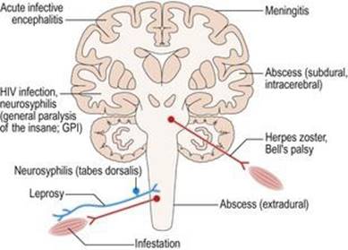 عفونت‌های سیستم عصبی عضلانی