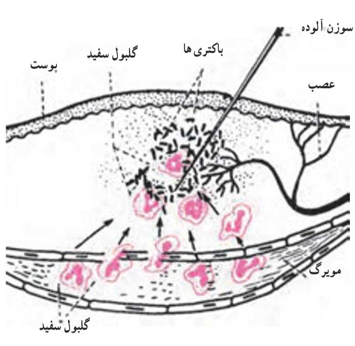 نمایش دیاپدز و دفاع موضعی بدن