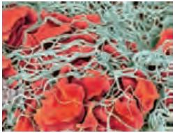 رشته های پروتئینی فیبرین که یاخته های خونی و گِرده ها را در برگرفته