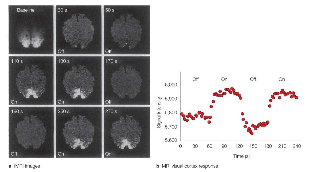 اولین مجموعه تصاویر از fMRI که روی انسان انجام شد