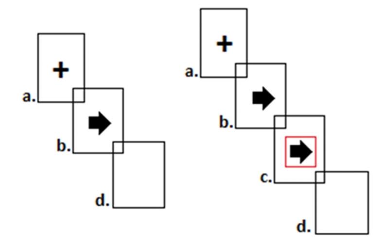 شکل 1. نمونه‌ای از توالی تصاویر نمایش‌داده‌شده در طول تسک سیگنال توقف (SST).