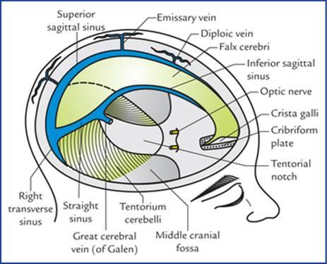 دیواره سختشامه و سینوسهای وریدی سختشامه از نمای فوقانی-جانبی