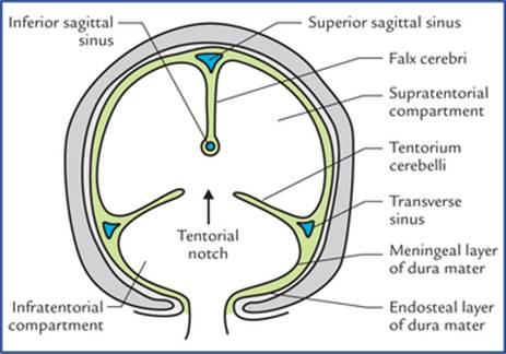 برش شماتیک تاجی جمجمه که تقسیم حفره جمجمه به سه بخش توسط داس مغزی و چادرینه مخچه را نشان میدهد
