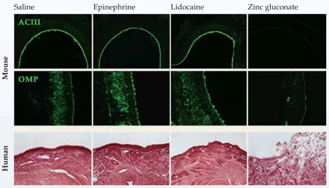 شکل CLINICAL فقط یک بینی. فصل ۱۵ کتاب علوم اعصاب پروس