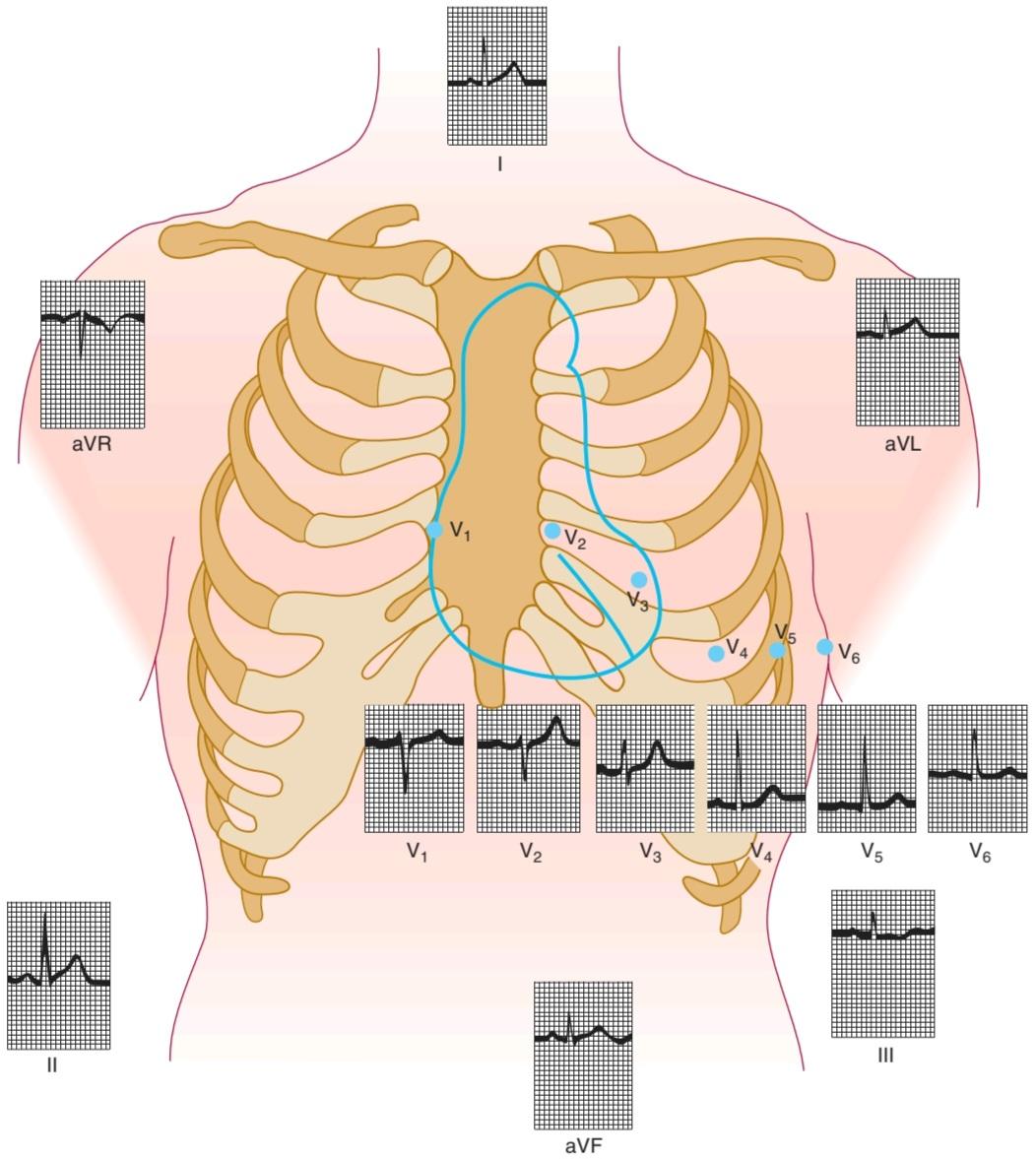 شکل ۲۹.۷ ECG طبیعی. کتاب گانونگ