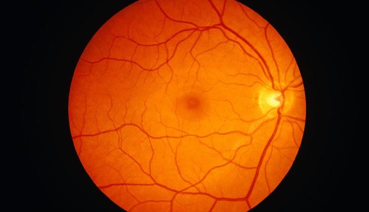 ناحیه لکه زرد (Macula Lutea)؛ شاهکار بیهمتای تکامل در قلب شبکیه چشم انسان