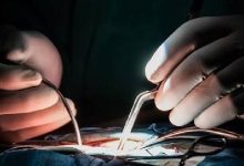 وظایف جراح مغز و اعصاب و ستون فقرات چیست؟ تفاوت با نورولوژیست