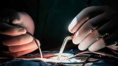 وظایف جراح مغز و اعصاب و ستون فقرات چیست؟ تفاوت با نورولوژیست