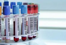 تقدیر و تشکر از خانم نسترن رضایی، کارشناس آزمایشگاه بیمارستان فیروزگر؛ به پاس همراهی و همکاری در مسیر پژوهش