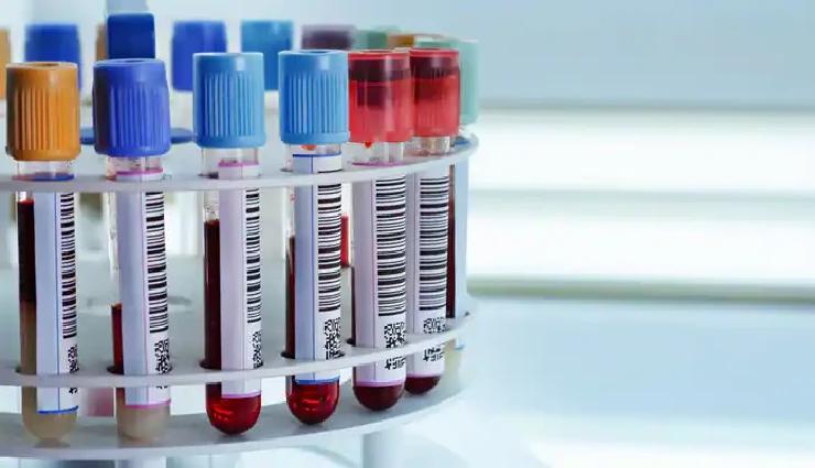 تقدیر و تشکر از خانم نسترن رضایی، کارشناس آزمایشگاه بیمارستان فیروزگر؛ به پاس همراهی و همکاری در مسیر پژوهش