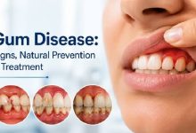 بیماری لثه و دریچه قلب؛ نقش Porphyromonas gingivalis و IL-1β در کلسیفیکاسیون دریچه آئورت