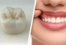 داروی جدید برای رشد مجدد دندان؛ آیا دندان دوباره درمی‌آید؟