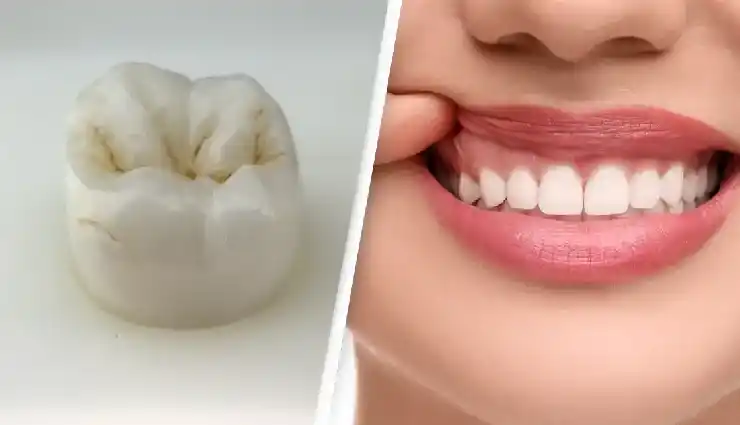 داروی جدید برای رشد مجدد دندان؛ آیا دندان دوباره درمی‌آید؟